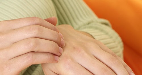 Ayurveda de la eccema las revocaciones